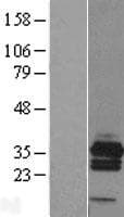 Human RCAN3 / Calcipressin 3 Protein (Over-Expression Lysate Myc-DDK (Flag))