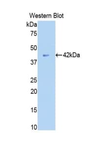 B2M / Beta 2 Microglobulin Antibody (aa1-142)