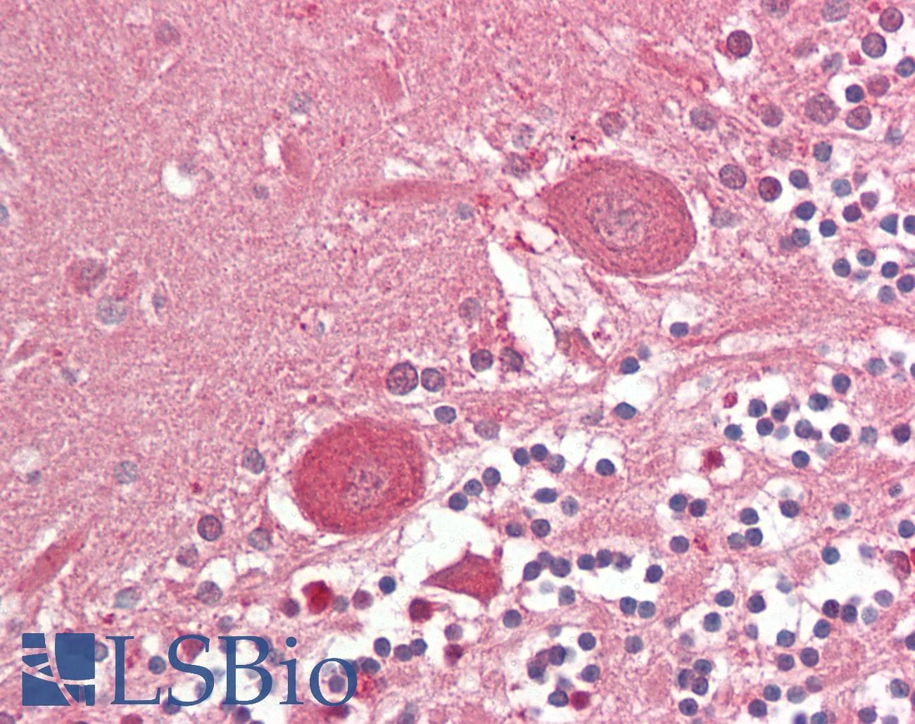 IHC-plus™ SHH / Sonic Hedgehog Antibody (clone 8G3)