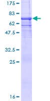 Human PGC / Pepsin C Protein (Recombinant GST)