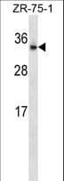 Polyclonal Rabbit anti-Human OTUB2 Antibody (aa19-48, WB)