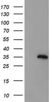FAM164A / CGI-62 Antibody (clone OTI4B5)