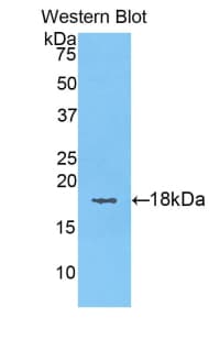 KRT6A / CK6A / Cytokeratin 6A Antibody (aa323-461)
