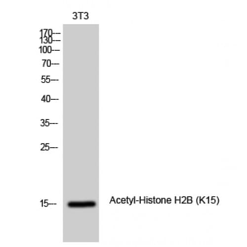Histone H2B Antibody (1-80 aa)