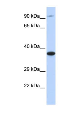 BBS5 Antibody (C-Terminus)
