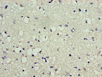 LSM10 Antibody (aa1-123)