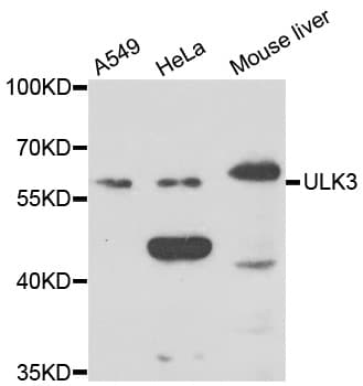 Polyclonal Rabbit anti-Human ULK3 Antibody (WB)