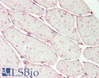 IHC-plus™ Polyclonal Rabbit anti-Human AIMP1 / EMAP II Antibody (IHC, IF, WB)