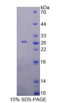 Rat YAF2 Protein (Recombinant His-T7)