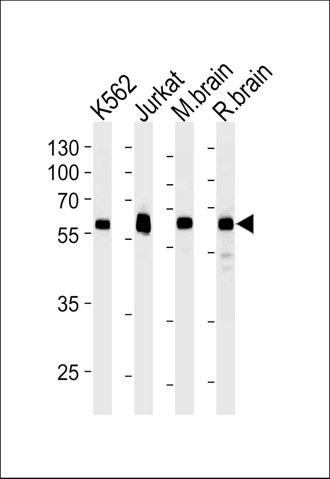 USP14 Antibody (clone 889CT6.2.1)