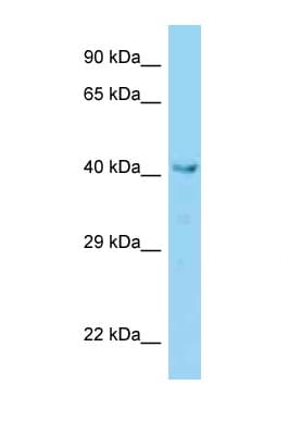 Polyclonal Rabbit anti-Mouse VPS36 Antibody (aa91-140, WB)
