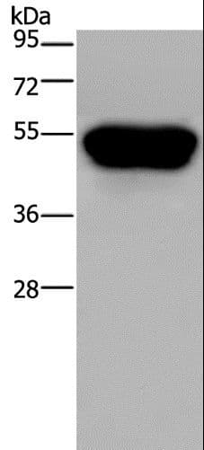 Polyclonal Rabbit anti-Human NK1 / CD160 Antibody (IHC, WB)