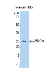 ZFAND6 Antibody (aa19-208, APC)