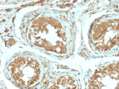 VTCN1 / B7-H4 Antibody (clone B7H4/2652R)