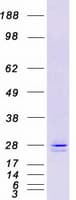 Human ERP29 Protein (Recombinant Myc-DDK (Flag))