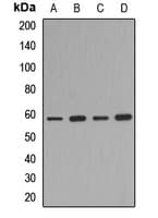 Polyclonal Rabbit anti-Human MITF Antibody (WB)