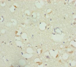 RBFOX1 / A2BP1 Antibody