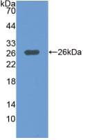 MAP3K1 / MEKK1 Antibody (aa1307-1509)