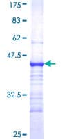 Human Complement C4b Protein (Recombinant GST, N-terminus)