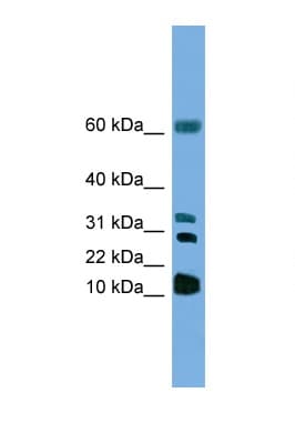 LTC4S / LTC4 Synthase Antibody (N-Terminus)
