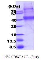 Human IL2RG / CD132 Protein (Recombinant His)