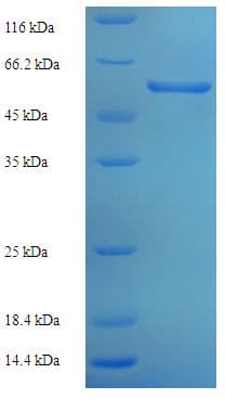 Mouse AGXT / SPT Protein (Recombinant His-SUMO)