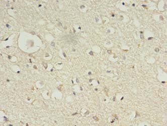 Polyclonal Rabbit anti-Human KIF12 Antibody (IHC)