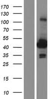Human ACY1 / Aminoacylase 1 Protein (Over-Expression Lysate Myc-DDK (Flag))