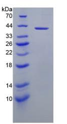 Human CASP9 / Caspase 9 Protein (Recombinant His-GST)