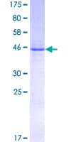 Human IL6 / Interleukin 6 Protein (Recombinant GST)
