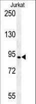 Polyclonal Rabbit anti-Human AXIN2 / Axin 2 Antibody (aa816-843, IHC, WB)