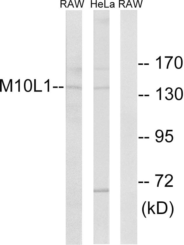 Polyclonal Rabbit anti-Human MOV10L1 Antibody (WB)