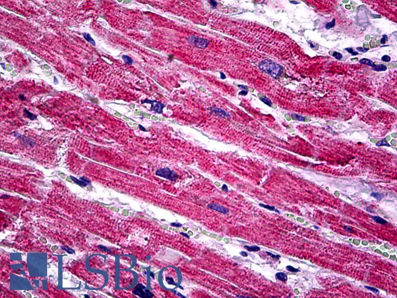 IHC-plus™ SPRY1 / Sprouty 1 Antibody (clone 3H4)