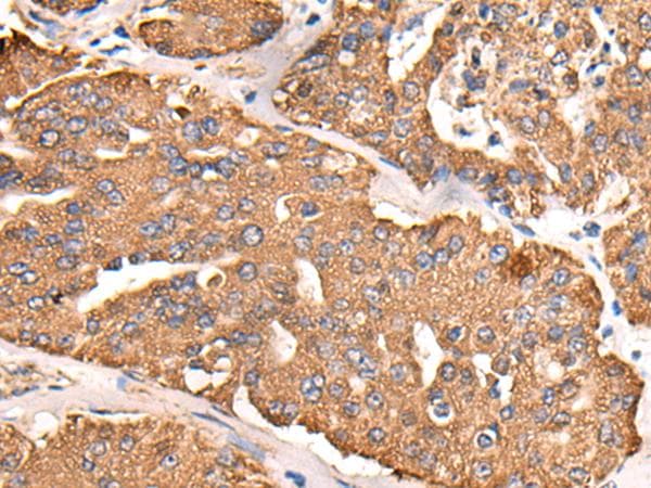 Polyclonal Rabbit anti-Human ATP5C1 Antibody (IHC, WB)