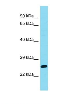 DIRAS2 Antibody (C-Terminus)