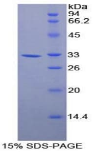 Mouse ANXA6/Annexin A6/Annexin VI Protein (Recombinant His-T7)