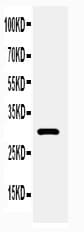 Adiponectin Antibody (aa19-244)