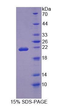 Rat OSTM1 Protein (Recombinant His-T7, N-terminus)