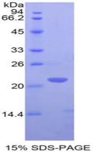 Human CD3E Protein (Recombinant His-T7)