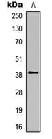 Polyclonal Rabbit anti-Human Rhodopsin / RHO Antibody (C-Terminus, WB)