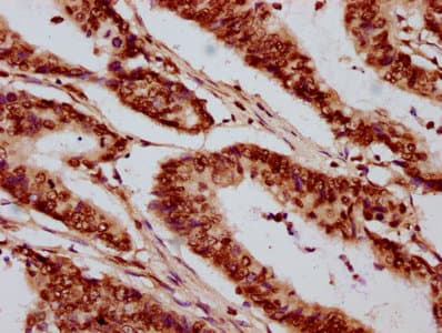 HIST1H2AI Antibody