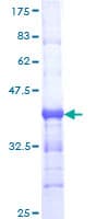 Human TCF7L1 / TCF-3 Protein (Recombinant GST, N-terminus)