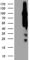 CENTG2 / AGAP1 Antibody (clone OTI4E8)