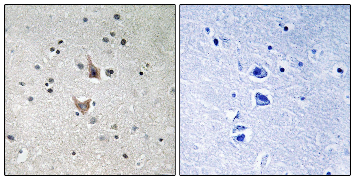 PSEN1 / Presenilin 1 Antibody (phospho-Ser357)