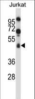 SPN / CD43 Antibody (aa230-257)