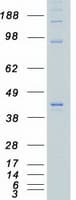 Human CSNK2A1 Protein (Recombinant Myc-DDK (Flag))