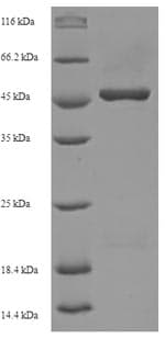 Human OLIG2 Protein (Recombinant 6His-SUMO, N-terminus)