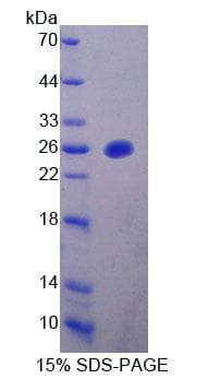 Mouse MTUS1 Protein (Recombinant His-T7)