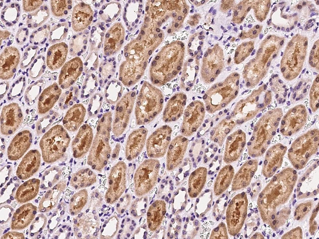Polyclonal Rabbit anti-Human GSS / Glutathione Synthetase Antibody (IHC)