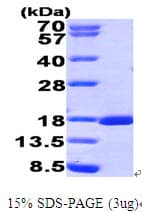 Human RUNX3 Protein (Recombinant His)